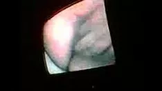 تشغيل الابهام غير المهنية